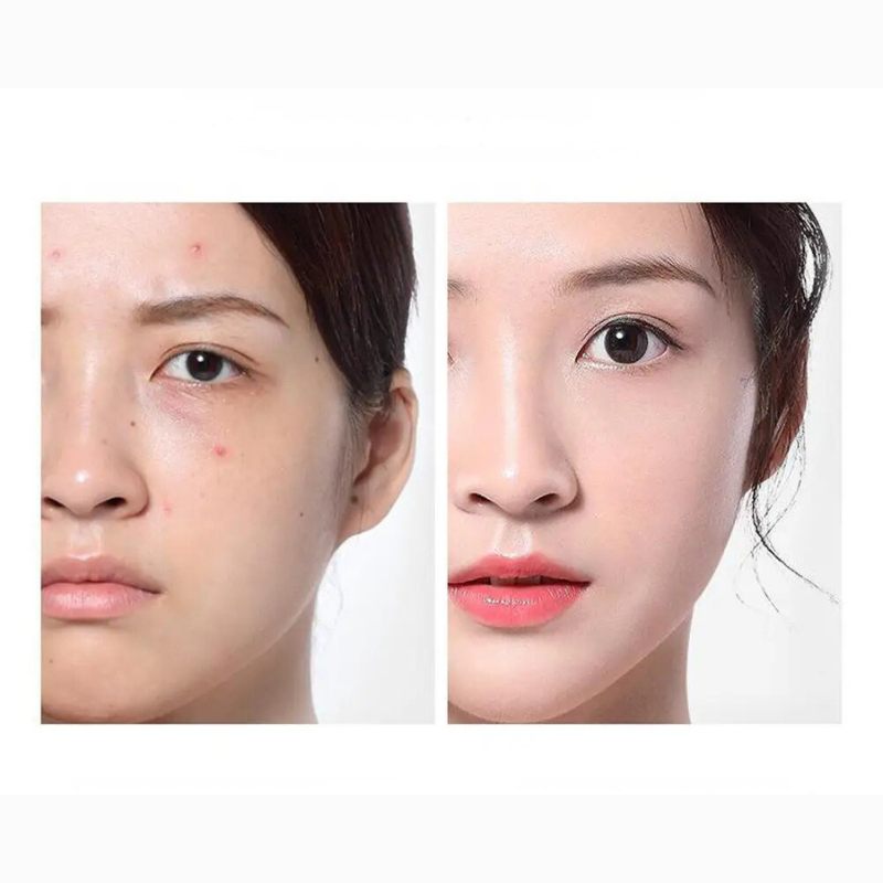 Acne-verzorgende toner en hydraterend serum – CLEARSKIN AMPOULE - Glamorix